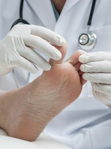 Athlete's Foot Treatment