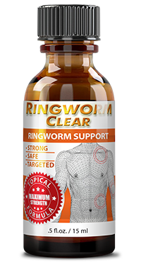 Ringworm Clear Bottle | Consumer Health