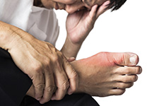 Gout Treatment